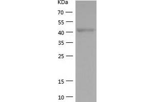 Western Blotting (WB) image for YY1 Transcription Factor (YY1) (AA 1-414) protein (His tag) (ABIN7285759) (YY1 Protein (AA 1-414) (His tag))