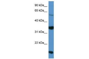 Western Blot showing NTNG2 antibody used at a concentration of 1-2 ug/ml to detect its target protein. (Netrin G2 antibody  (Middle Region))