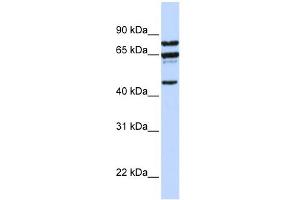 WB Suggested Anti-PPP4R2 Antibody Titration:  0. (PPP4R2 antibody  (C-Term))