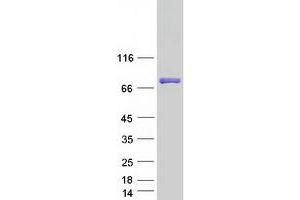 KH Domain Containing 4, Pre-mRNA Splicing Factor (KHDC4) protein (Myc-DYKDDDDK Tag)