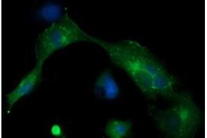 Image no. 3 for anti-Melan A (MLANA) antibody (ABIN1499426) (MLANA antibody)