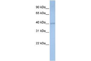 WB Suggested Anti-PDSS1 Antibody Titration:  0. (PDSS1 antibody  (Middle Region))