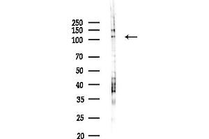 anti-TAO Kinase 3 (TAOK3) (Internal Region) antibody
