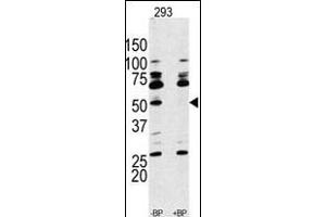 Western blot analysis of anti-RPS6KB1 Antibody (Center) Pab (ABIN389685 and ABIN2839654) pre-incubated with and without blocking peptide (BPNULL) in 293 cell line lysate. (RPS6KB1 antibody  (AA 277-306))