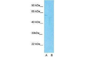 Host:  Rabbit  Target Name:  YAP1  Sample Type:  Human Fetal Lung cell  Lane A:  Primary Antibody  Lane B:  Primary Antibody + Blocking Peptide  Primary Antibody Concentration:  1ug/ml  Peptide Concentration:  5. (YAP1 antibody  (C-Term))