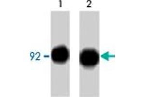 Western blot analysis of CTNNB1 immunoprecipitated from A-431 cells treated with pervanadate. (CTNNB1 antibody  (C-Term))