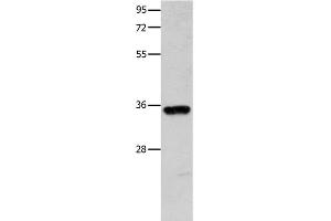 Western Blot analysis of Mouse brain tissue using COX11 Polyclonal Antibody at dilution of 1:600 (COX11 antibody)