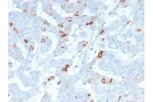 Formalin-fixed, paraffin-embedded human Colon stained with MUC2 Rabbit Recombinant Monoclonal Antibody (MLP/2970R). (Recombinant MUC2 antibody)