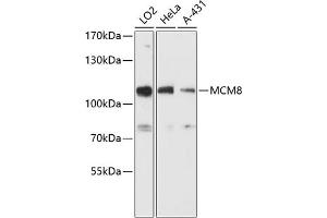 Western blot analysis of extracts of various cell lines, using MCM8 antibody (ABIN6129652, ABIN6143648, ABIN6143649 and ABIN6216734) at 1:3000 dilution. (MCM8 antibody  (AA 591-840))