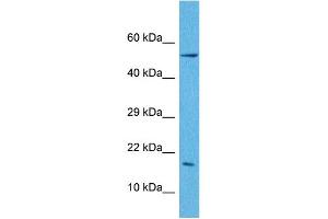Host:  Rabbit  Target Name:  LEP  Sample Tissue:  Human A549 Whole Cell  Antibody Dilution:  1ug/ml (Leptin antibody  (N-Term))