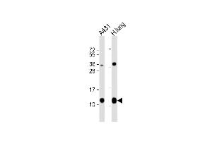 All lanes : Anti-S100A10 Antibody (Center) at 1:8000 dilution Lane 1: A431 whole cell lysate Lane 2: human lung lysate Lysates/proteins at 20 μg per lane. (S100A10 antibody  (AA 12-40))