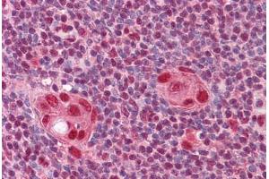 Human Thymus: Formalin-Fixed, Paraffin-Embedded (FFPE) (CUX1 antibody  (AA 521-621))