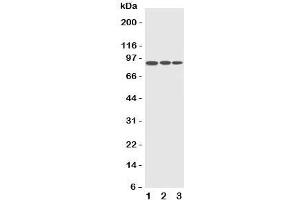 Western blot testing of CDC5L antibody and Lane 1:  HeLa;  2: Raji;  3: A549 cell lysate.