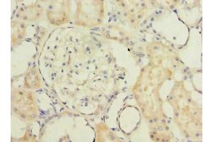 Immunohistochemistry of paraffin-embedded human kidney tissue using ABIN7173115 at dilution of 1:100 (TMEM186 antibody  (AA 124-213))