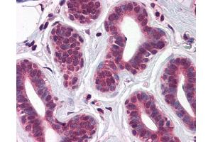 IHC Information: Paraffin embedded breast tissue, tested with an antibody dilution of 5 ug/ml. (T-Box 18 antibody  (C-Term))