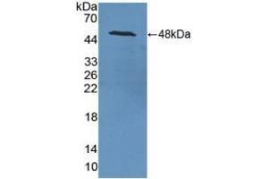 Detection of Recombinant NSE, Rat using Polyclonal Antibody to Enolase, Neuron Specific (NSE) (ENO2/NSE antibody  (AA 2-434))