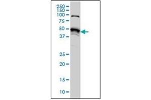 Western Blotting (WB) image for anti-serine/threonine Kinase 38 (STK38) (AA 365-466) antibody (ABIN954986) (STK38 antibody  (AA 365-466))