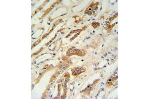ZFYVE16 Antibody (N-term) (ABIN651313 and ABIN2840182) IHC analysis in formalin fixed and paraffin embedded lung tissue followed by peroxidase conjugation of the secondary antibody and DAB staining. (ZFYVE16 antibody  (N-Term))