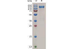 SDS-PAGE (SDS) image for Fms-Related tyrosine Kinase 1 (VEGFR1) (FLT1) (AA 27-756) protein (His tag) (ABIN7490835)