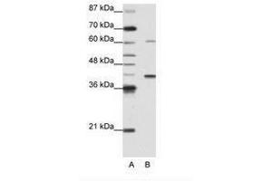 Image no. 1 for anti-Zinc Finger Protein 843 (ZNF843) (AA 41-90) antibody (ABIN6736171) (ZNF843 antibody  (AA 41-90))