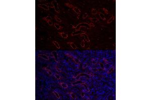Immunofluorescence analysis of mouse kidney cells using  Rabbit pAb (ABIN3016811, ABIN3016812, ABIN3016813, ABIN1678723 and ABIN6219847) at dilution of 1:150 (40x lens). (AQP3 antibody  (AA 178-292))