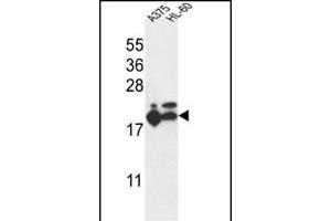 RPL17 Antibody (C-term) (ABIN653848 and ABIN2843111) western blot analysis in ,HL-60 cell line lysates (35 μg/lane). (RPL17 antibody  (C-Term))