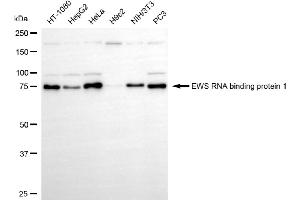 anti-Ewing Sarcoma Breakpoint Region 1 (EWSR1) antibody
