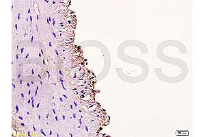 Formalin-fixed and paraffin embedded rabbit carotid artery labeled Anti-Cyclin D3 Polyclonal Antibody, Unconjugated (ABIN671571) at 1:200, followed by conjugation to the secondary antibody and DAB staining (Cyclin D3 antibody  (AA 121-220))