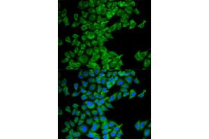 Immunofluorescence (IF) image for anti-Second Mitochondria-Derived Activator of Caspase (DIABLO) antibody (ABIN1872269)