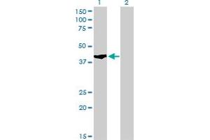 Western Blot analysis of SHOX2 expression in transfected 293T cell line by SHOX2 monoclonal antibody (M01), clone 1D1. (SHOX2 antibody  (AA 117-204))