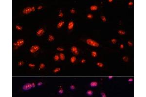 Immunofluorescence analysis of U-2 OS cells using ILF3 Polyclonal Antibody at dilution of 1:100. (Interleukin enhancer-binding factor 3 (ILF3) antibody)