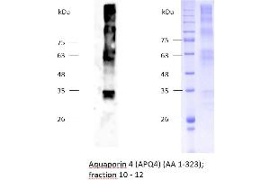Image no. 2 for Aquaporin 4 (AQP4) (AA 1-323) protein (rho-1D4 tag,His tag) (ABIN3089096) (Aquaporin 4 Protein (AQP4) (AA 1-323) (rho-1D4 tag,His tag))
