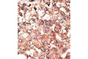Image no. 2 for anti-Bone Morphogenetic Protein 5 (BMP5) (N-Term) antibody (ABIN357183)