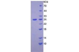 SDS-PAGE (SDS) image for Tyrosine Protein Kinase 7 (AA 853-1070) protein (His tag) (ABIN4988407)