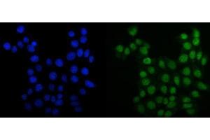 IF analysis of MCM6 using anti-MCM6 antibody (ABIN7600036).