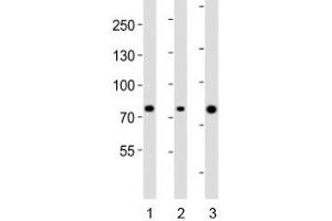 Western blot analysis of lysate from human 1) ovary, 2) placenta and 3) plasma lysate using Integrin beta 8 antibody diluted at 1:1000. (ITGB8 antibody  (AA 197-231))