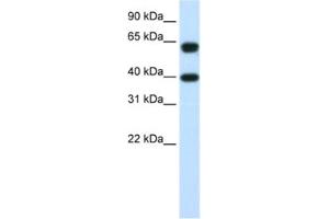 Western Blotting (WB) image for anti-Nuclear RNA Export Factor 3 (NXF3) antibody (ABIN2462273) (NXF3 antibody)