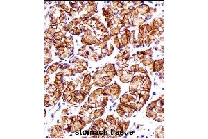 Immunohistochemistry (Paraffin-embedded Sections) (IHC (p)) image for anti-Catenin (Cadherin-Associated Protein), beta 1, 88kDa (CTNNB1) (AA 78-106), (N-Term) antibody (ABIN1881239)