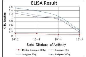 Red: Control Antigen (100 ng), Purple: Antigen (10 ng), Green: Antigen (50 ng), Blue: Antigen (100 ng), (KIF22 antibody)