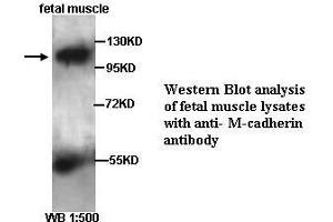 Image no. 2 for anti-M-Cadherin (CDH15) (Internal Region) antibody (ABIN790873) (CDH15 antibody  (Internal Region))