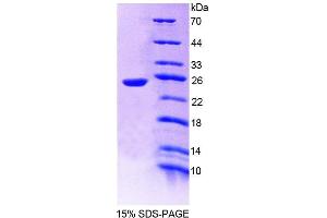 SDS-PAGE (SDS) image for Protein Tyrosine Phosphatase, Receptor Type, U (PTPRU) (AA 1263-1446) protein (His tag) (ABIN6239277) (PTPRU Protein (AA 1263-1446) (His tag))