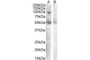 Image no. 1 for anti-Sulfatase 2 (SULF2) (Internal Region) antibody (ABIN375090) (SULF2 antibody  (Internal Region))