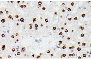 Immunohistochemistry of paraffin-embedded Rat liver using HNRNPD Polyclonal Antibody at dilution of 1:100 (40x lens).