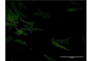 Immunofluorescence of monoclonal antibody to ACE on HeLa cell. (Angiotensin I Converting Enzyme 1 antibody  (AA 592-701))
