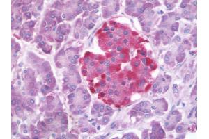 Human Pancreas: Formalin-Fixed, Paraffin-Embedded (FFPE) (GLP1R antibody  (N-Term))