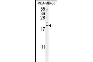 LYRM4 Antikörper  (AA 43-69)