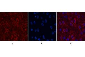 Immunofluorescence analysis of rat brain tissue. (AMACR antibody)