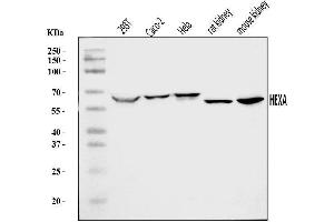 Western blot analysis of HEXA using anti-HEXA antibody (ABIN7599980).