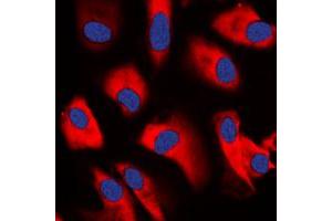 Immunofluorescent analysis of CDC37 staining in K562 cells. (CDC37 antibody  (Center))