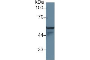 Western Blot; Sample: Human A431 cell lysate; Primary Ab: 1µg/ml Rabbit Anti-Rat KRT4 Antibody Second Ab: 0.